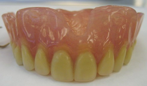 Eating With New Dentures Cocoa FL 32922